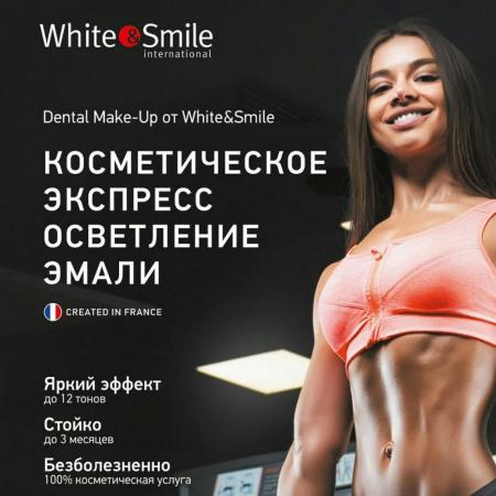 Фотография White&Smile 4